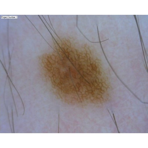 MEDL4D DermaScope (1.3MPix)