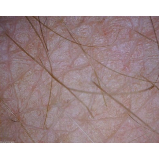 MEDL4D DermaScope (1.3MPix)