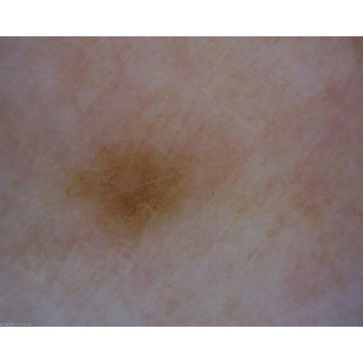 MEDL4D DermaScope (1.3MPix)