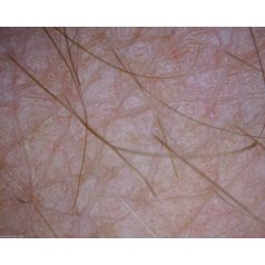 Dermatolog_mikroskop