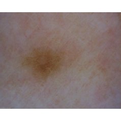 Dermatolog_mikroskop