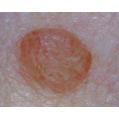 Dermatolog_mikroskop