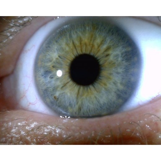 MEDL4R IriScope (1.3MPix) USB mikroskop