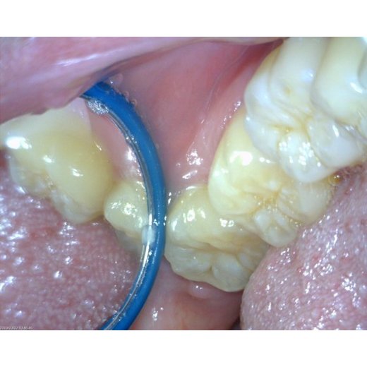 MEDL4T DentalScope (1.3MPix)