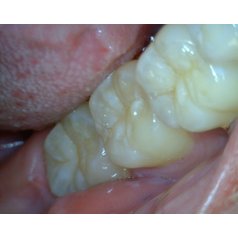 DentalScope MEDL4T