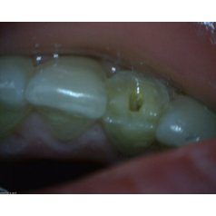 DentalScope MEDL4T