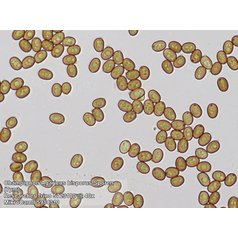 Bresser Researcher Trino 40-1000x Mikroskop